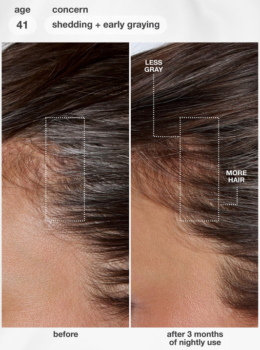 FutureIQTM biomimetic hair longevity serum