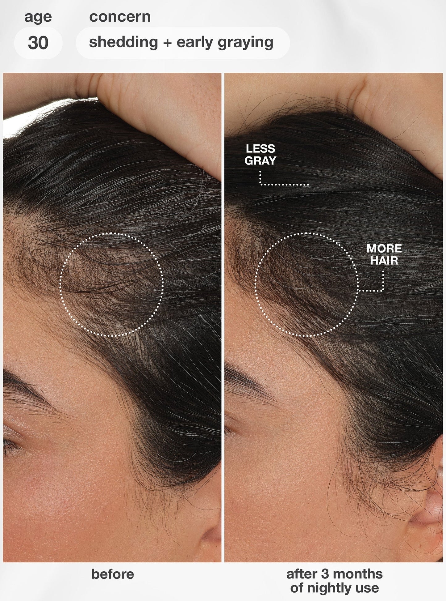 FutureIQTM biomimetic hair longevity serum