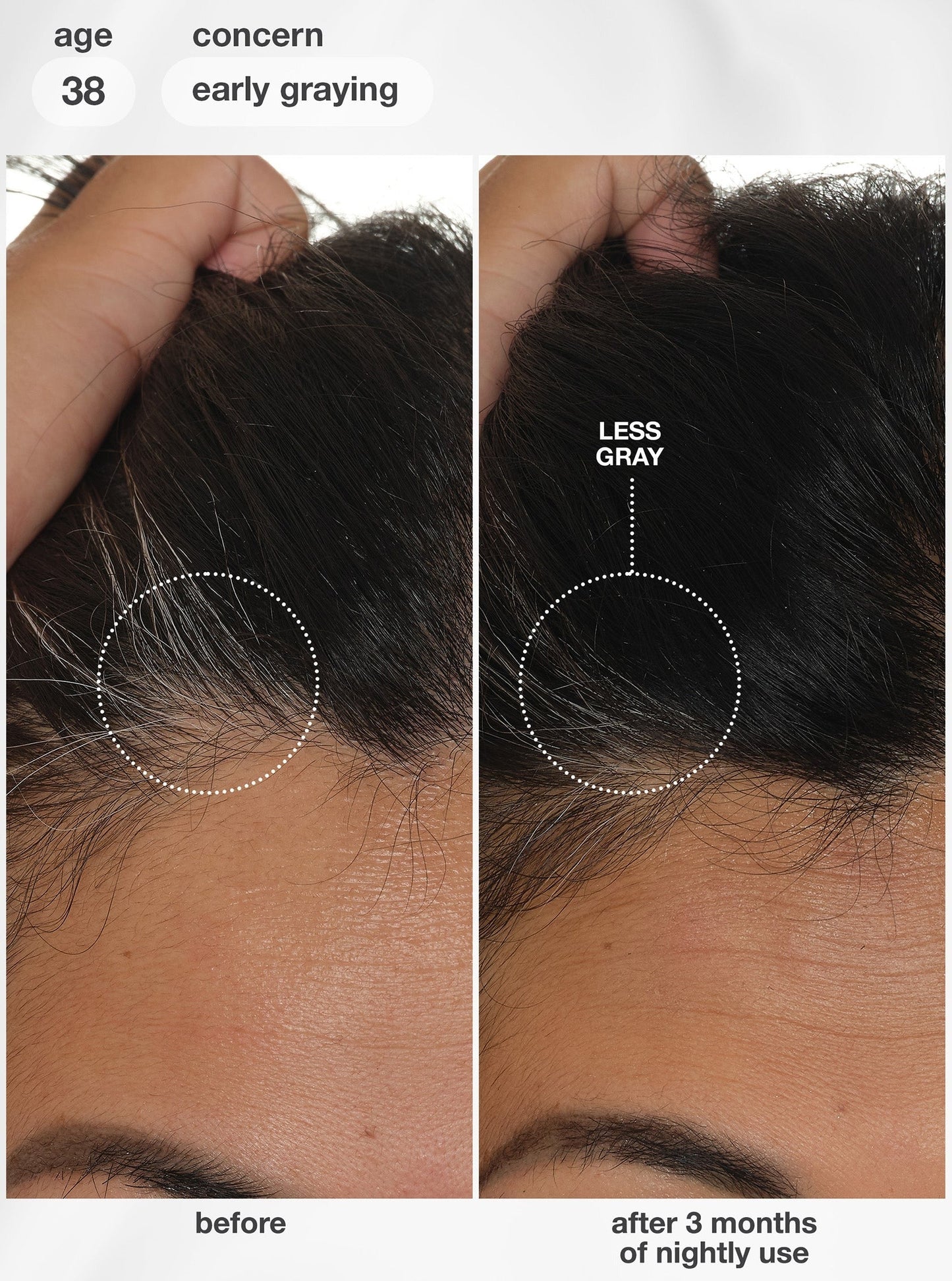 FutureIQTM biomimetic hair longevity serum